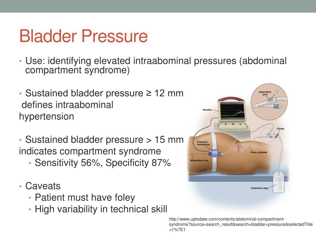 PPT Acute Kidney Injury PowerPoint Presentation, free download ID PPT Acute Kidney Injury PowerPoint Presentation, free download ID