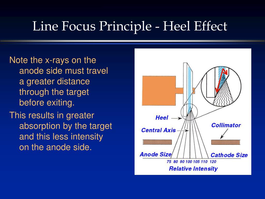 Anode Heel Effect (X-Ray Tube)_哔哩哔哩_bilibili