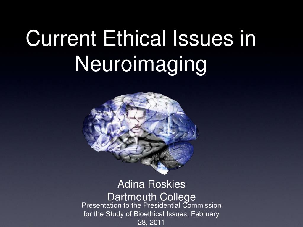 PPT Current Ethical Issues in Neuroimaging PowerPoint Presentation