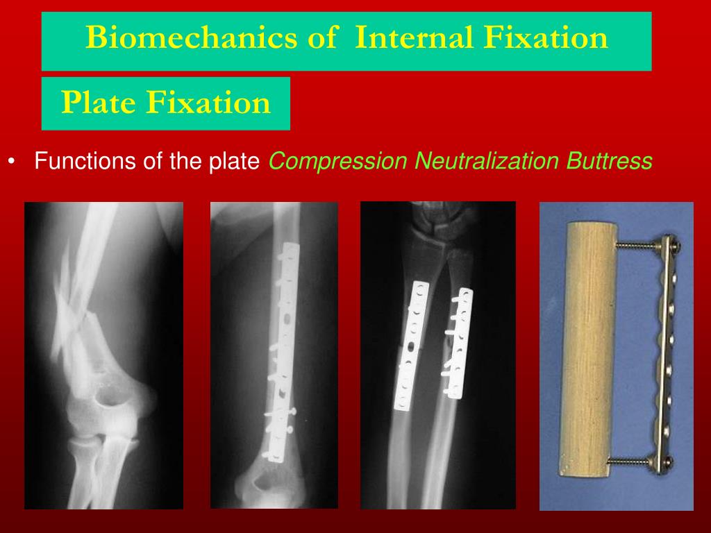 PPT - Biomechanics in Human Body PowerPoint Presentation, free download