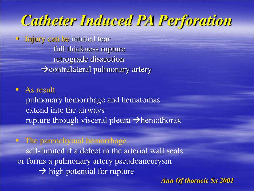 PPT - Catheter Induced PA Perforation PowerPoint Presentation, free ...