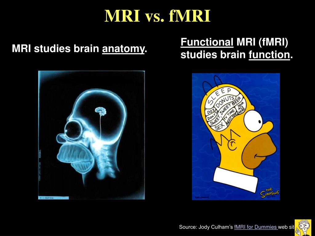 new research is using functional mri quizlet