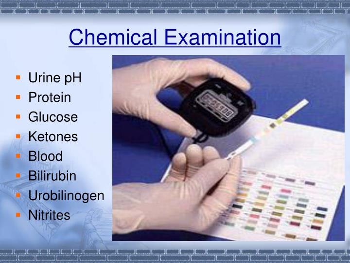 PPT Urinalysis PowerPoint Presentation ID5498707