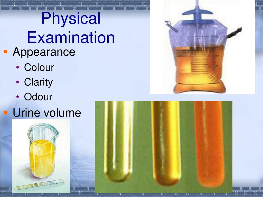 powerpoint presentation on urinalysis