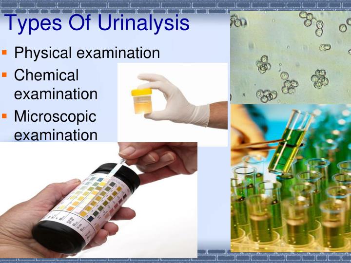 PPT - Urinalysis PowerPoint Presentation - ID:5498707