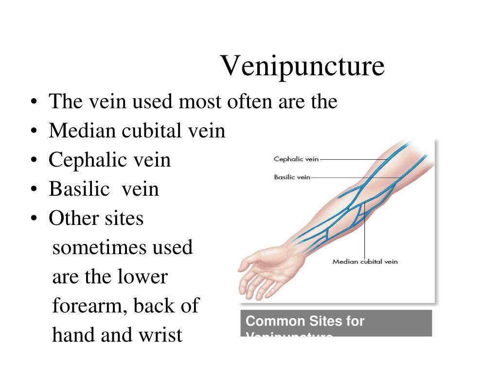 venipuncture sites diagram venipuncture sites diagram