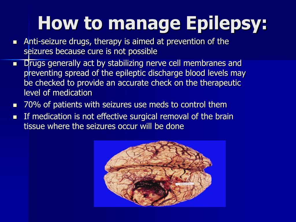 PPT Epilepsy PowerPoint Presentation Free Download ID 5503170