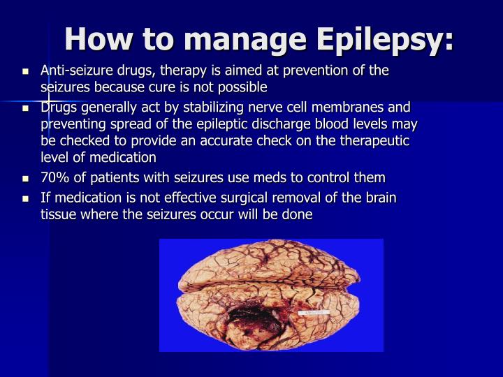 powerpoint presentation on epilepsy