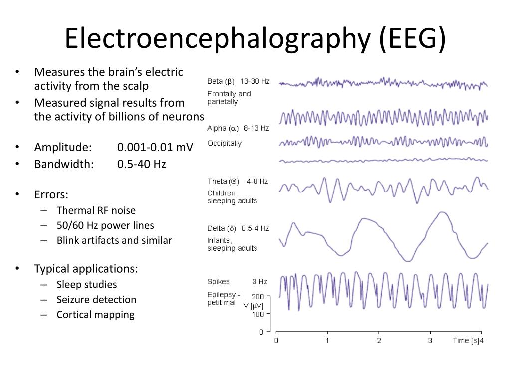 PPT - What is EEG ? PowerPoint Presentation, free download - ID:5505871