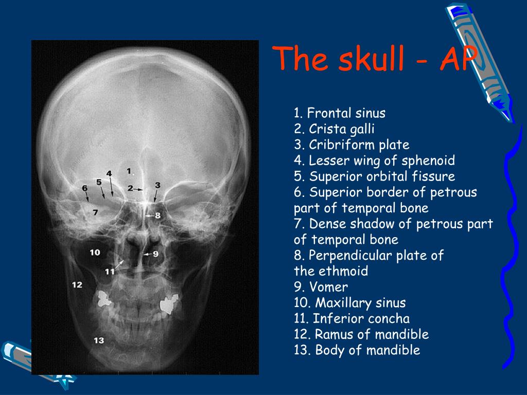 PPT - Radiographic anatomy of the skeletal PowerPoint Presentation