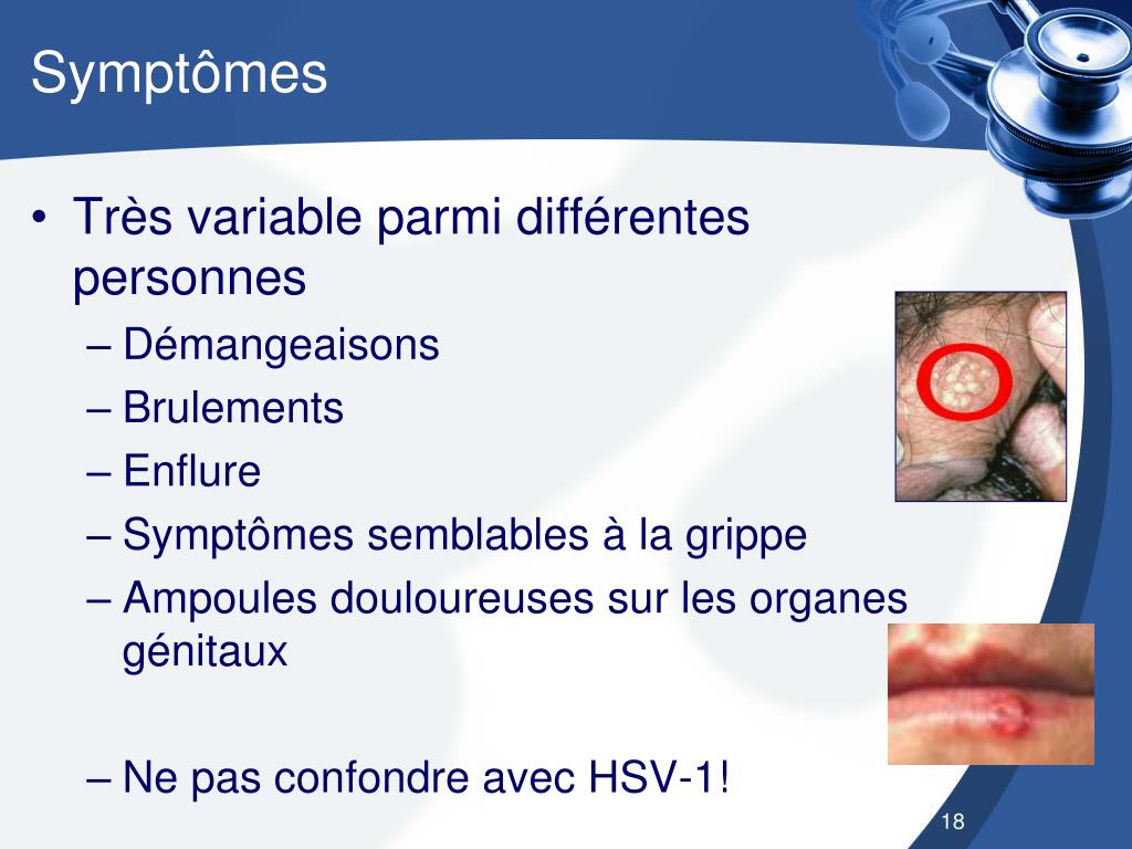 Quand Apparaissent Les Premiers Symptômes D'une Mst Chez La Femme PPT - Les Maladies Transmises Sexuellement (MTS) PowerPoint