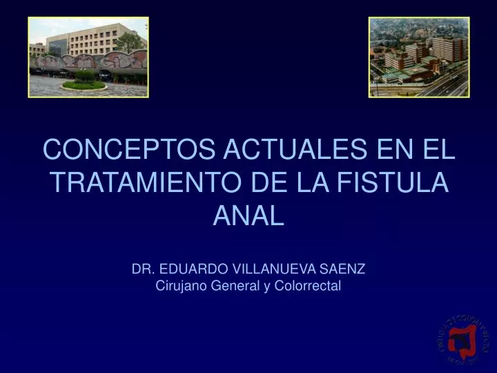 conceptos actuales en el tratamiento de la fistula anal n.