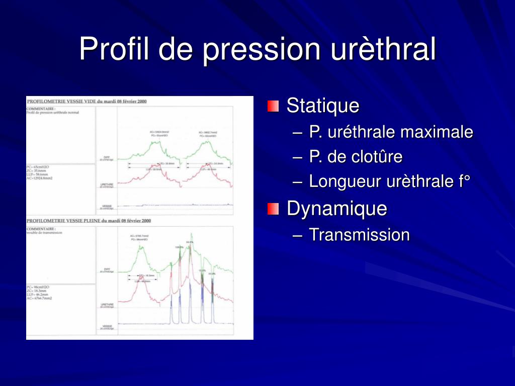 PPT - Incontinence urinaire du Sujet âgé PowerPoint Presentation, free ...