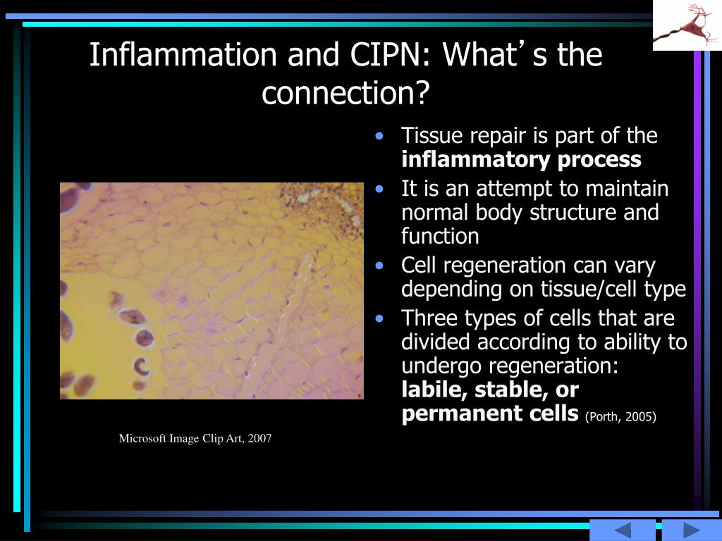 PPT - Chemotherapy-Induced Peripheral Neuropathy (CIPN ...