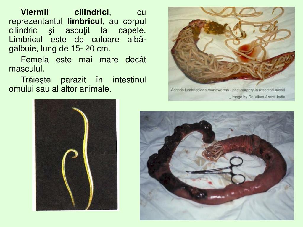 Viermi paraziti ppt. Tratarea copilului cu viermi - grandordeluxe.ro