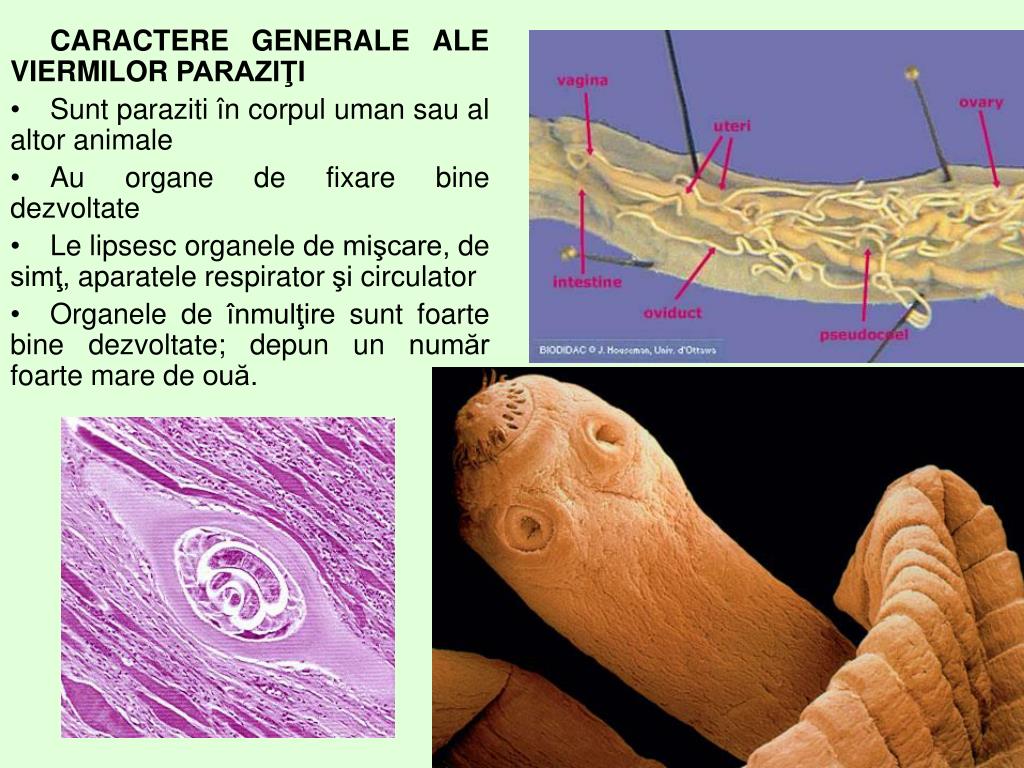 Les vers paraziti de l homme, Papillomavirus homme oeil