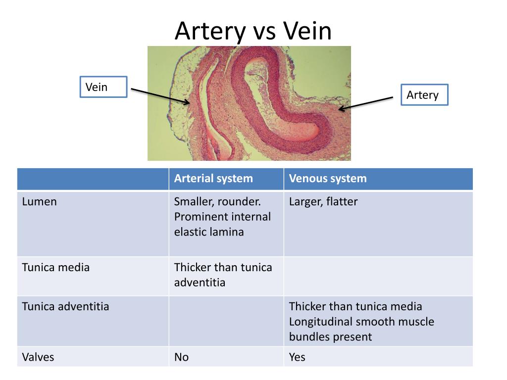 PPT - Histology for Pathology Circulatory System PowerPoint