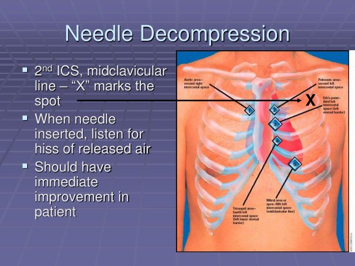 PPT Trauma Morbidity and Mortality PowerPoint Presentation ID5526361