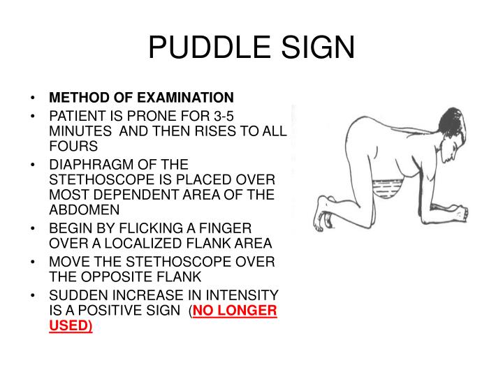 Normal Puddle Sign PPT - بسم الله الرحمن الرحيم PowerPoint Presentation - ID:5527912