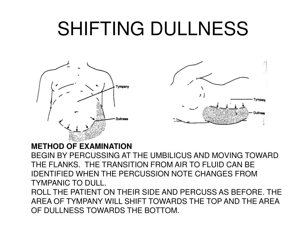 What Is The Two Steps Of Shifting Dullness JPUOYG