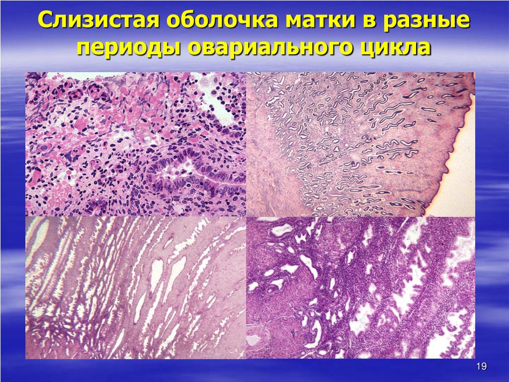 Слизистая оболочка матки. Слизистой оболочкой Матеи. Слизистые оболочки матки. Слизистая оболочка матки образована.