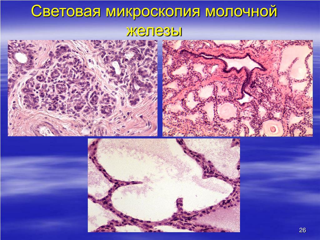 Микроскопия молочной железы. Микроскопирование молока. Молочная железа микроскопия.