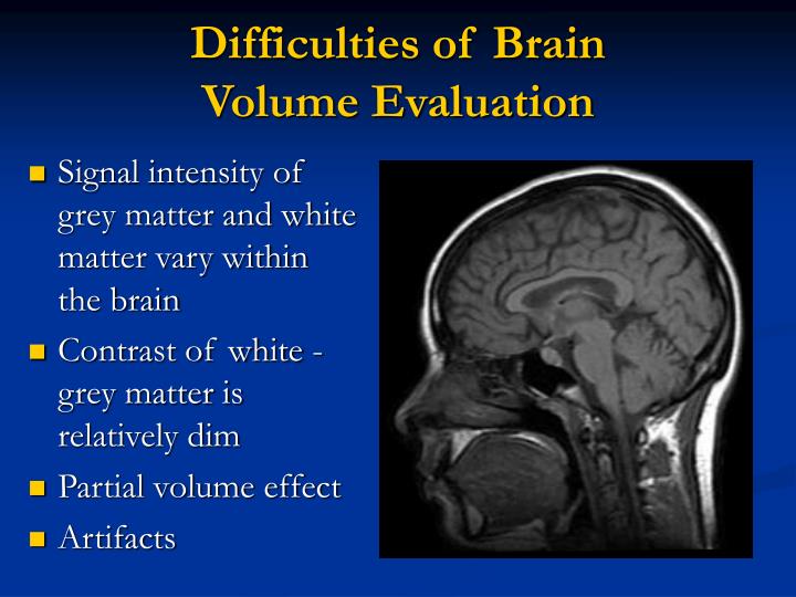 analysis of grey matter Grey matter asymmetry analysis in left- and right-handers sebastian ocklenburg. analysis of grey matter Grey matter asymmetry analysis in left- and right-handers sebastian ocklenburg.