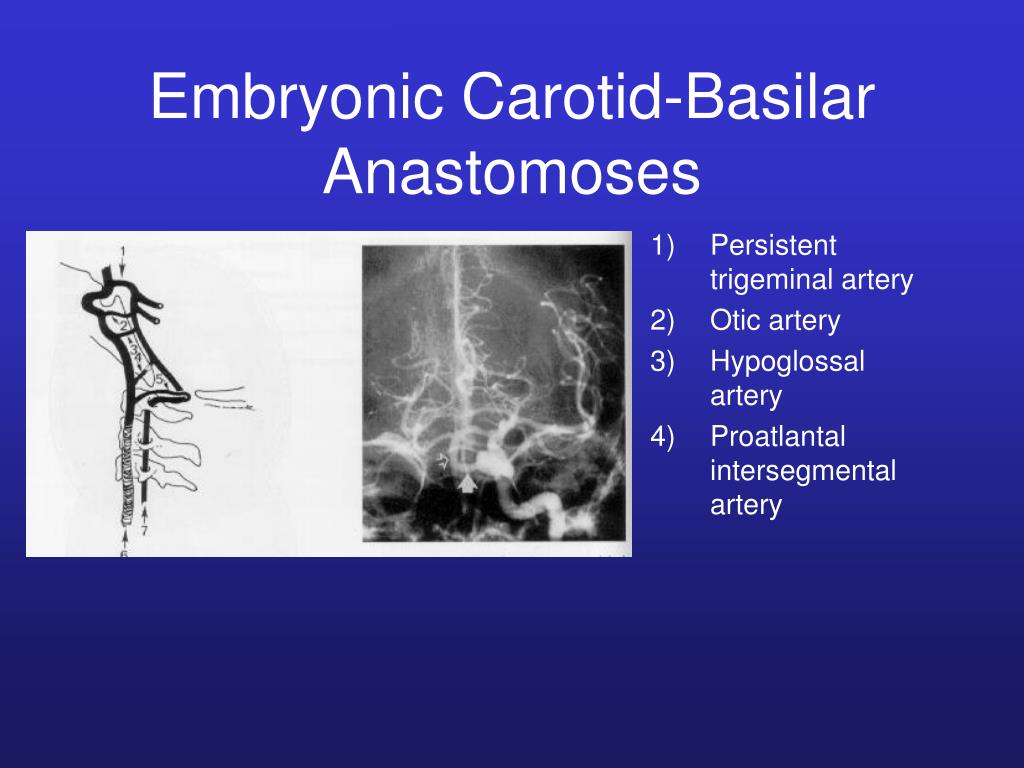 PPT - Cerebrovascular Embryology October 6, 2000 PowerPoint ...