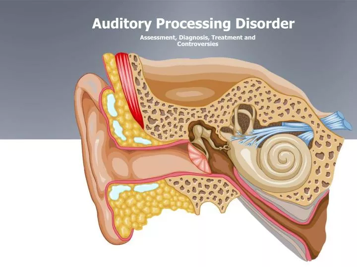 PPT Auditory Processing Disorder PowerPoint Presentation Free