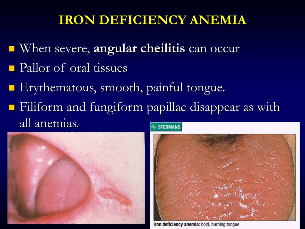 Ppt Oral Manifestations Of Systemic Diseases Powerpoint Presentation Id5557459 4683