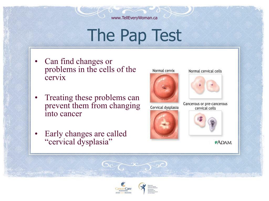 hpv can cause cervical cancer. true false dont know