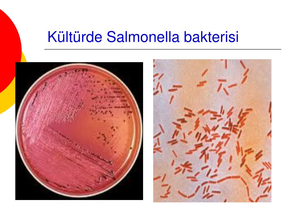 Сальмонеллез материал. Houtenae сальмонелла. Salmonella typhi микробиология. Сальмонелла рисунок микробиология. Сальмонеллез микробиология.