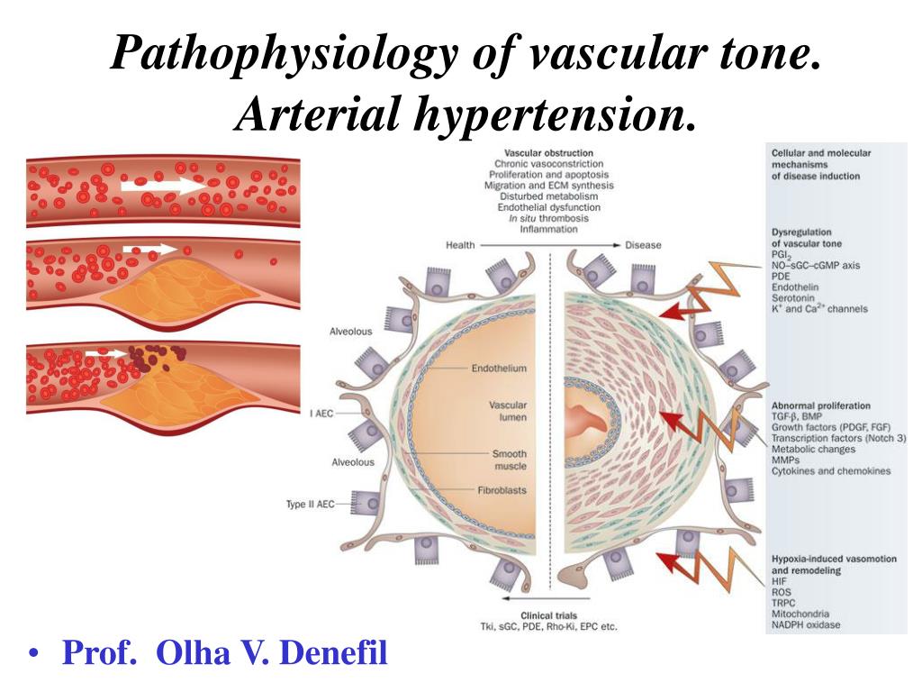hipertenzija, vaskularni tonus)