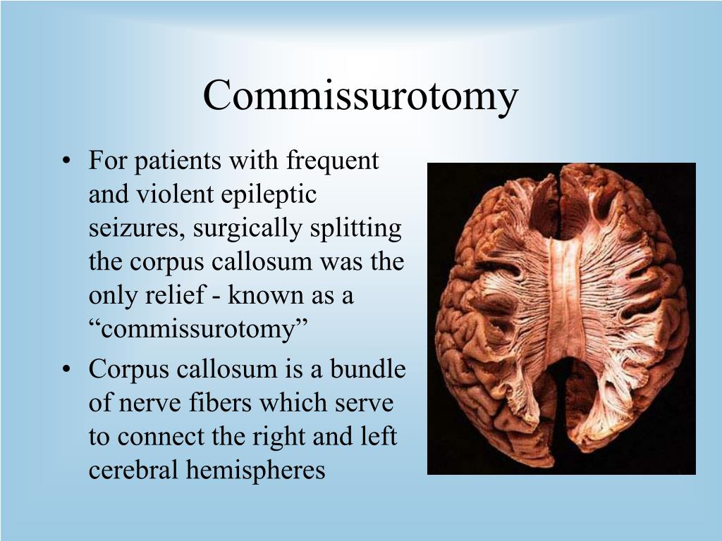 PPT The Split Brain PowerPoint Presentation Free Download ID 5592668