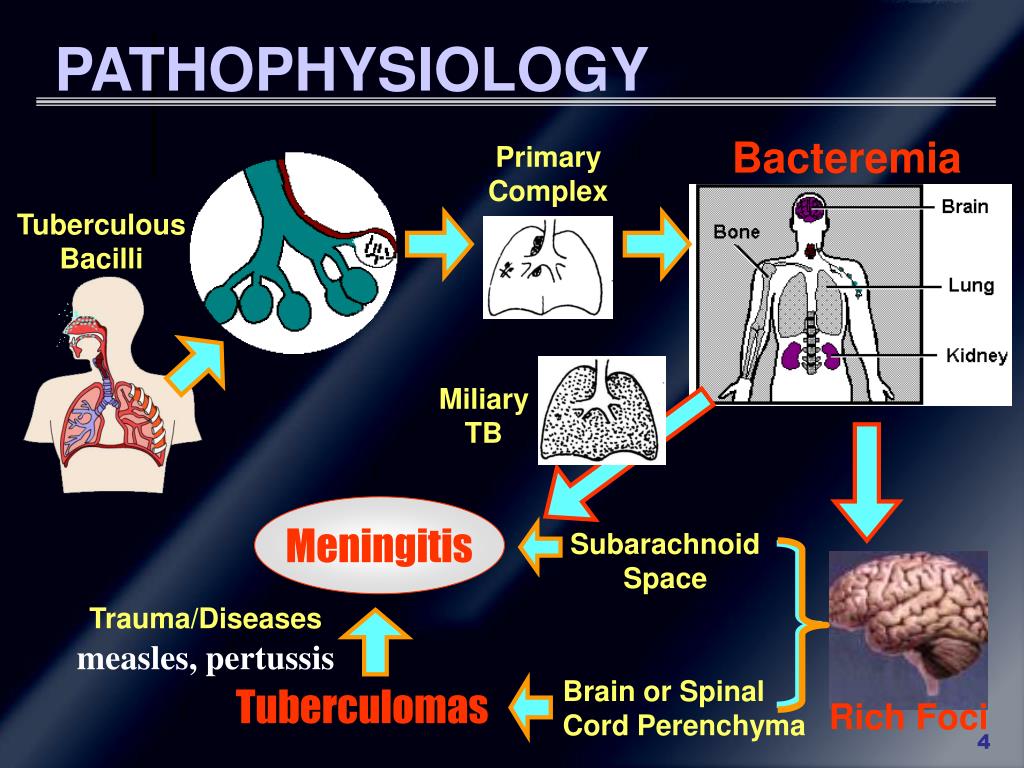 PPT - Tuberculous Meningitis PowerPoint Presentation, Free Download ...