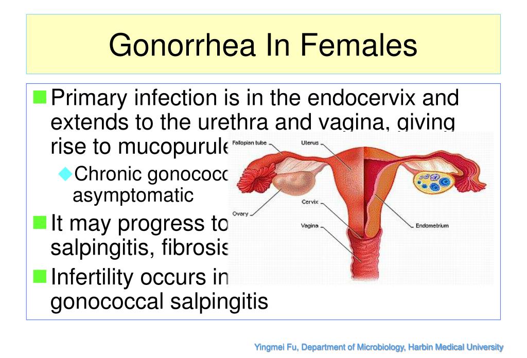gonorrhea symptoms in anus