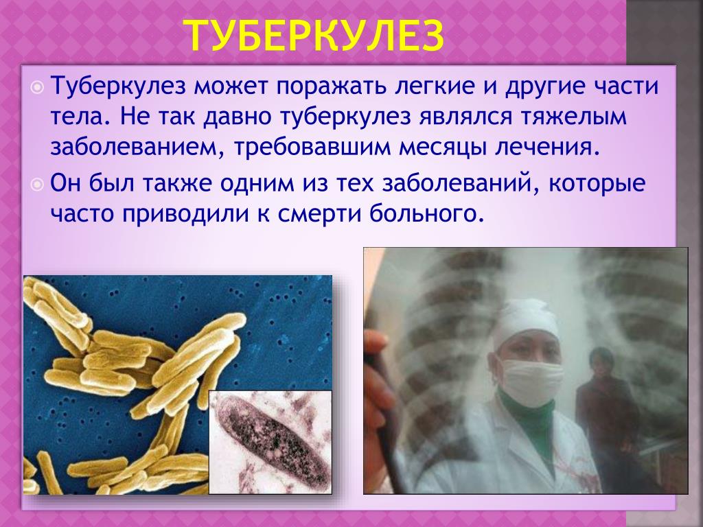 Туберкулез биология. Tuberkulyoza.