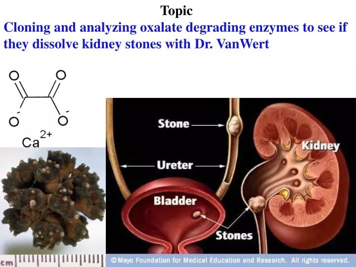 a description and analysis of a kidney stone The surgical management of kidney stone disease: a population based time series analysis michael ordon, david urbach, muhammad mamdani, refik saskin. a description and analysis of a kidney stone The surgical management of kidney stone disease: a population based time series analysis michael ordon, david urbach, muhammad mamdani, refik saskin.