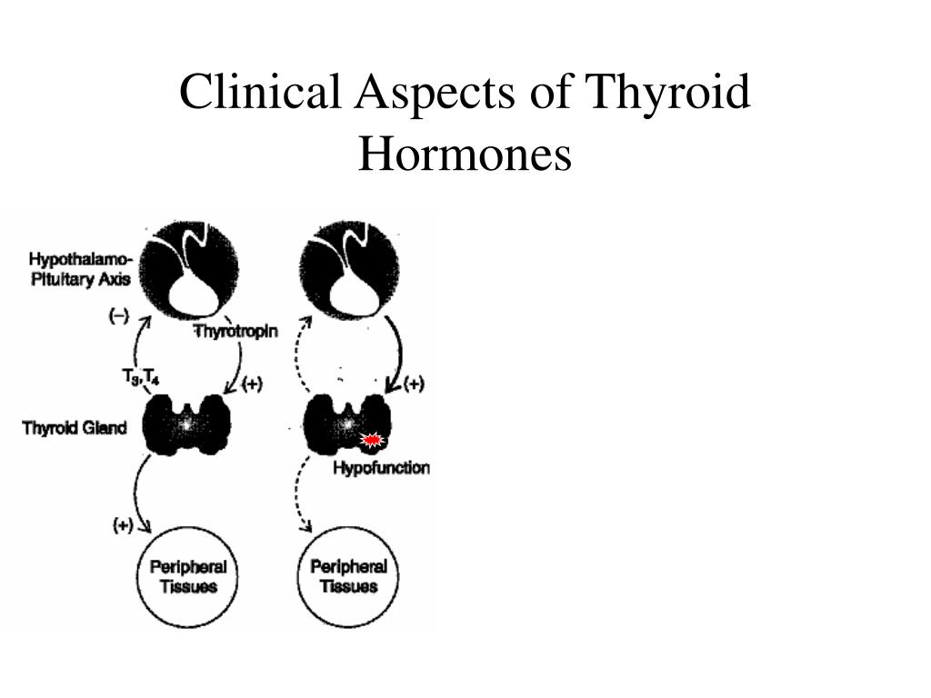 Ppt Goiter Powerpoint Presentation Free Download Id5614351