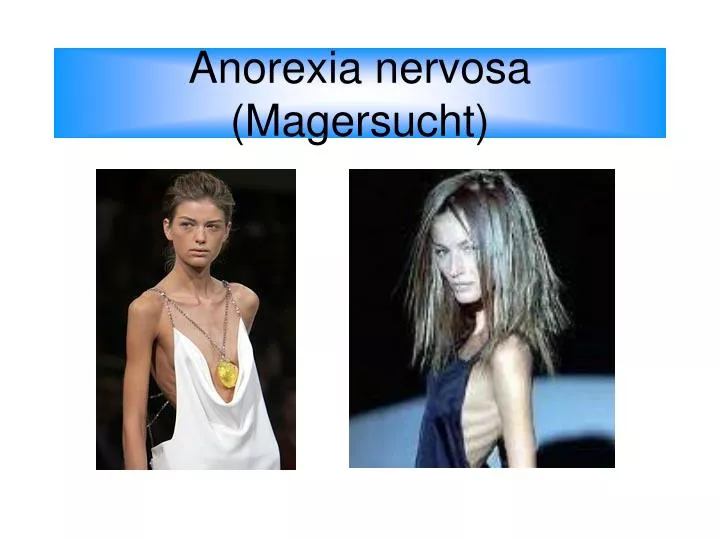 anorexia essay nervosa Read story anorexia vs bulimia (a comparison and contrast essay) by writermarie23 (lindsey jones) with 15,348 reads essay, disorders, eating anorexia vs bul. anorexia essay nervosa Read story anorexia vs bulimia (a comparison and contrast essay) by writermarie23 (lindsey jones) with 15,348 reads essay, disorders, eating anorexia vs bul.