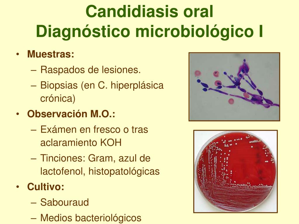 PPT - Micología Médica PowerPoint Presentation, Free Download - ID:5616537