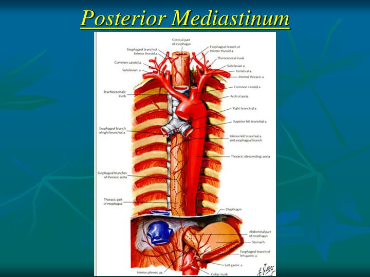 PPT - Mediastinum PowerPoint Presentation - ID:5617803