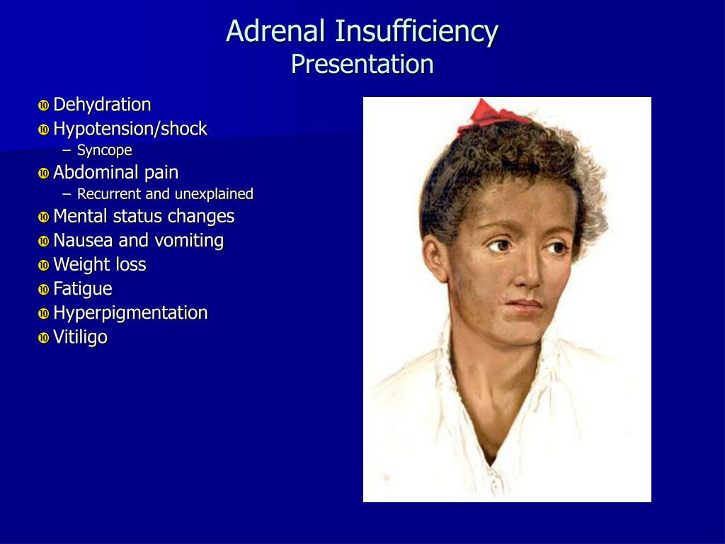 adrenaline deficit disorder adrenaline deficit disorder