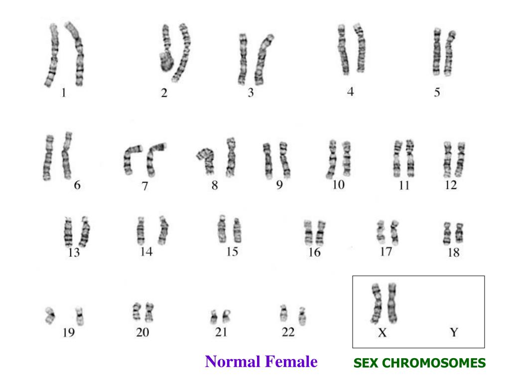 Хромосомный набор клеток мужчин