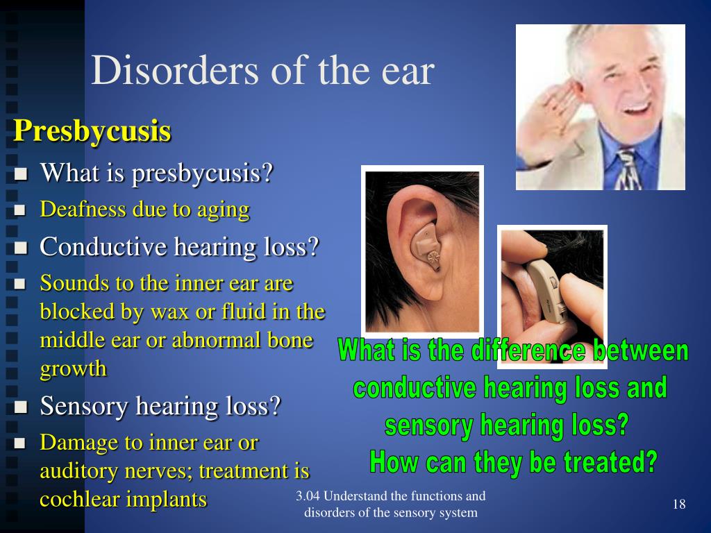 Ppt 304 Functions And Disorders Of The Ear Powerpoint Presentation