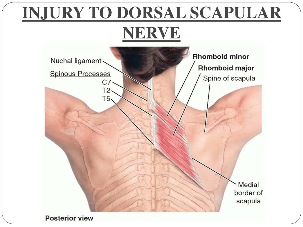 Ppt Nerves Of Upper Limb Their Lesions Powerpoint Presentation Id 5626116