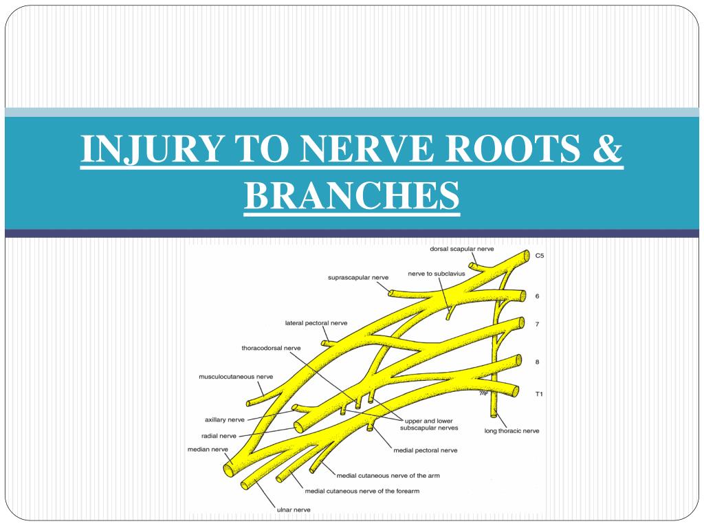PPT - NERVES OF UPPER LIMB & THEIR LESIONS PowerPoint Presentation - ID