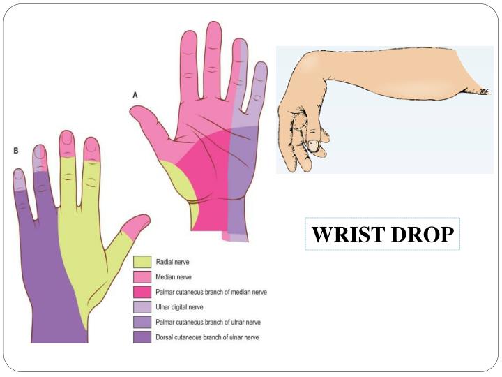 PPT NERVES OF UPPER LIMB & THEIR LESIONS PowerPoint Presentation ID