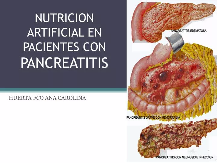 alimentacion para personas con pancreatitis