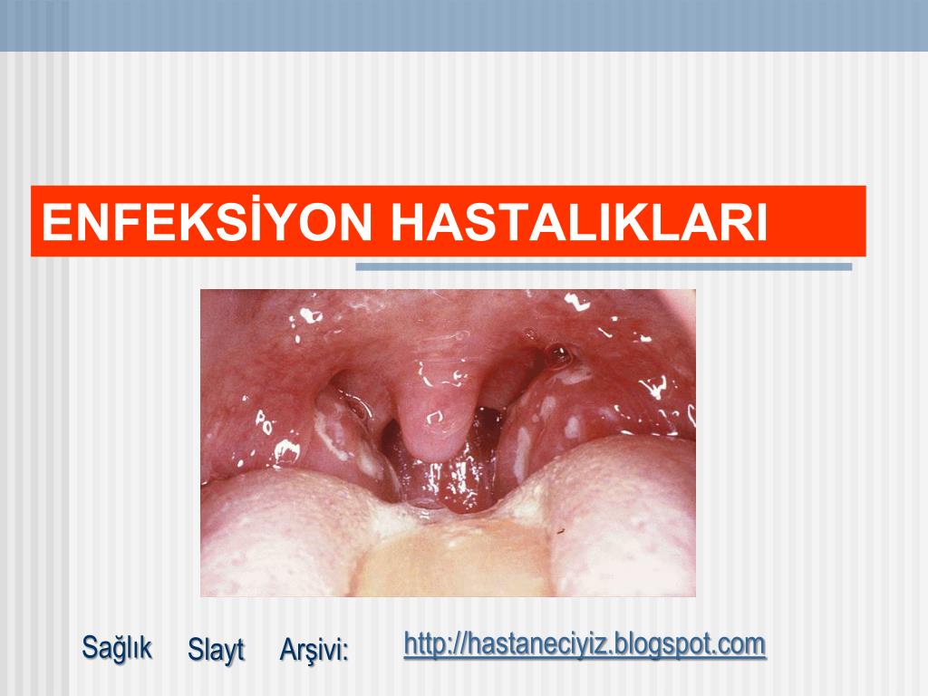 Staphylococcus bir çocuk: belirtileri ve tedavisi Staphylococcus bir çocuk: belirtileri ve tedavisi